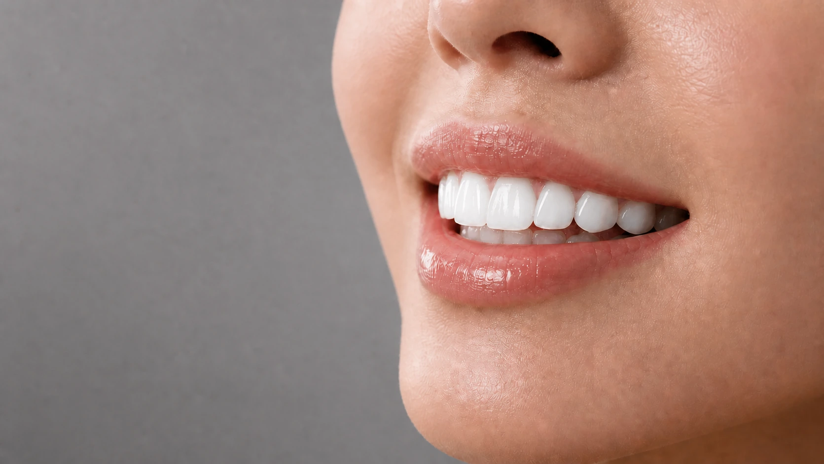 贴片后亮白自然的全瓷牙贴片效果 / After ceramic veneers with a brighter natural smile